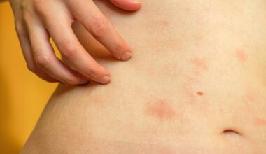 Paying attention to your body may change how an acute skin inflammation unfolds
