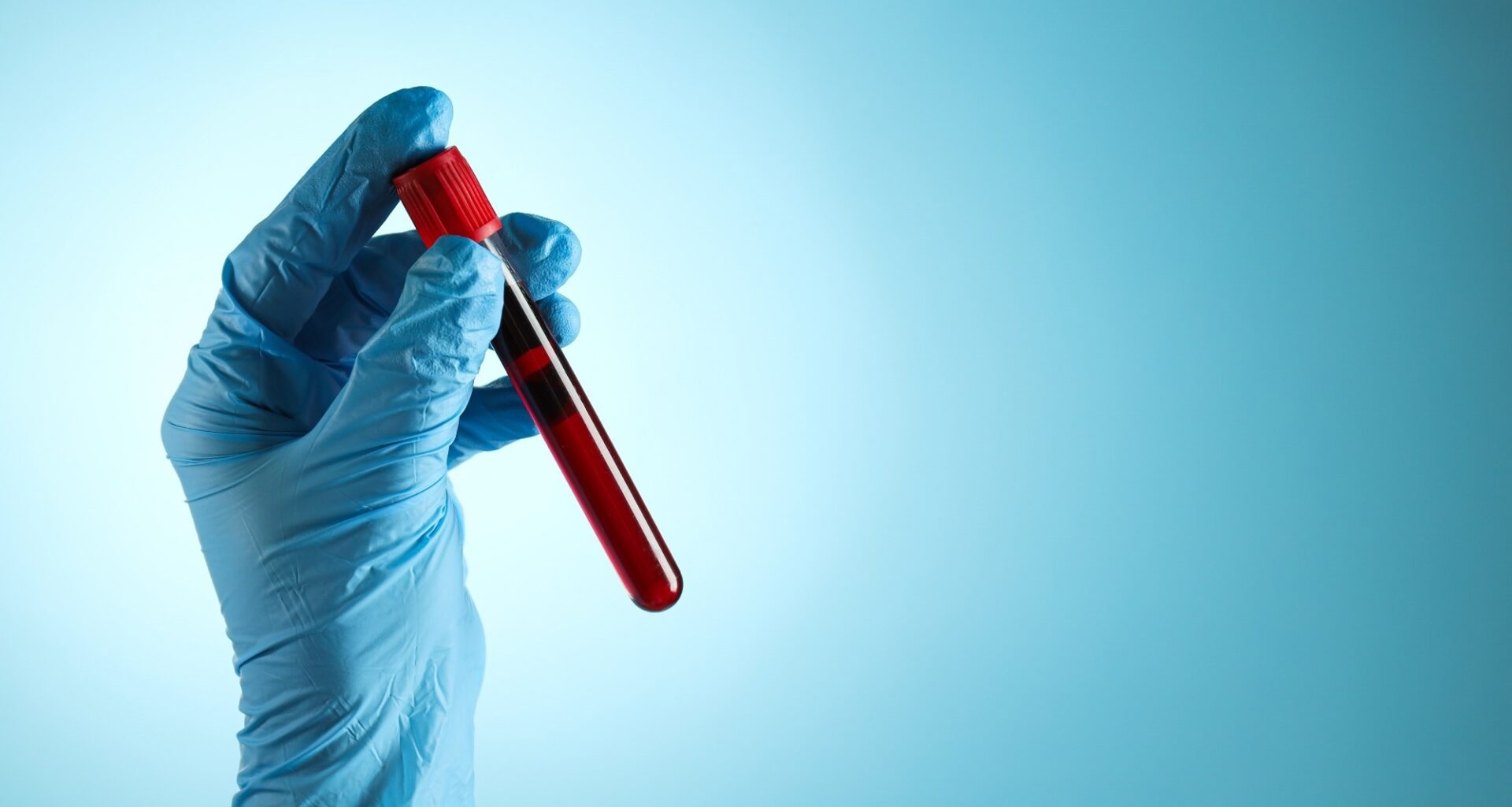 Spotlight: Translating cellular aging clocks into disease risk prediction. Image Credit: AtlasStudio / Shutterstock