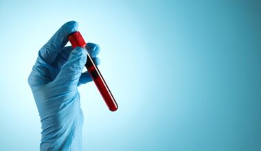 Spotlight: Translating cellular aging clocks into disease risk prediction. Image Credit: AtlasStudio / Shutterstock