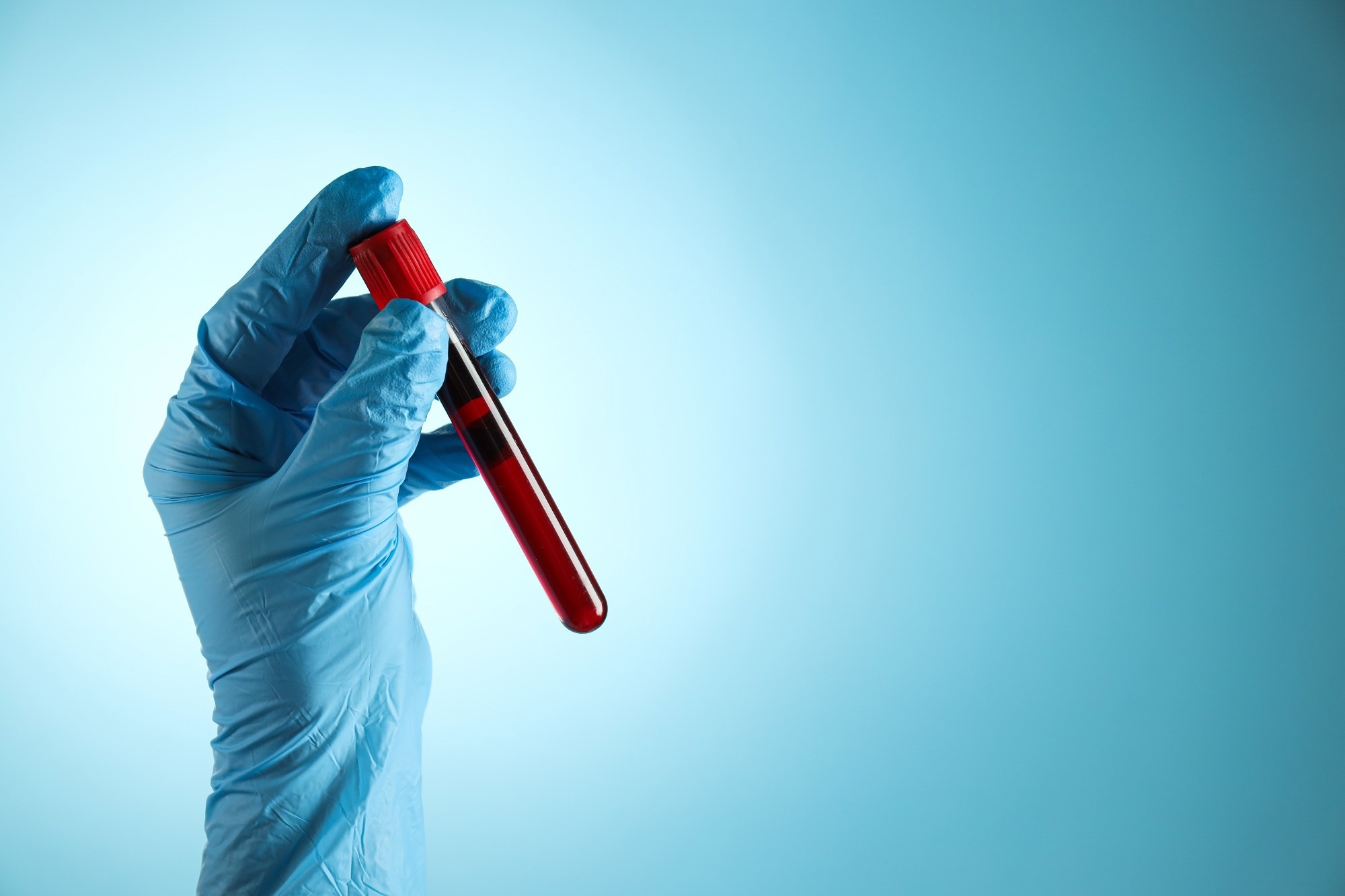Spotlight: Translating cellular aging clocks into disease risk prediction. Image Credit: AtlasStudio / Shutterstock