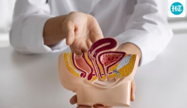 Why more young adults are being diagnosed with colon cancer: Oncologist Dr Ravi K Gupta shares risk factors and symptoms