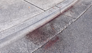 Boy fighting for life after alleged teen stabbing on NSW Central Coast