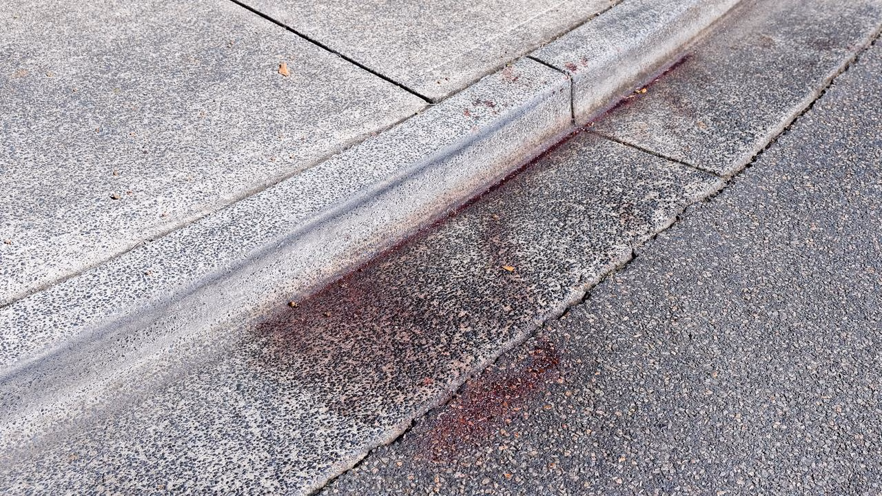 Boy fighting for life after alleged teen stabbing on NSW Central Coast