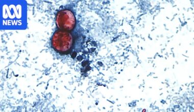 Outbreak of Cyclospora parasite spreads even further across United States