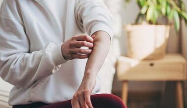 Antihistamines may not offer meaningful relief from eczema symptoms