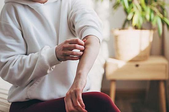 Antihistamines may not offer meaningful relief from eczema symptoms