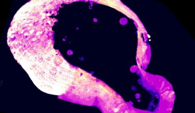Cells Deploy Rare Molecule to Shield from Iron Overload