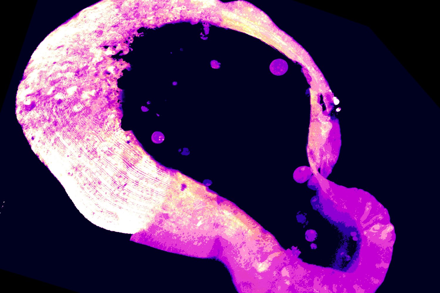 Cells Deploy Rare Molecule to Shield from Iron Overload