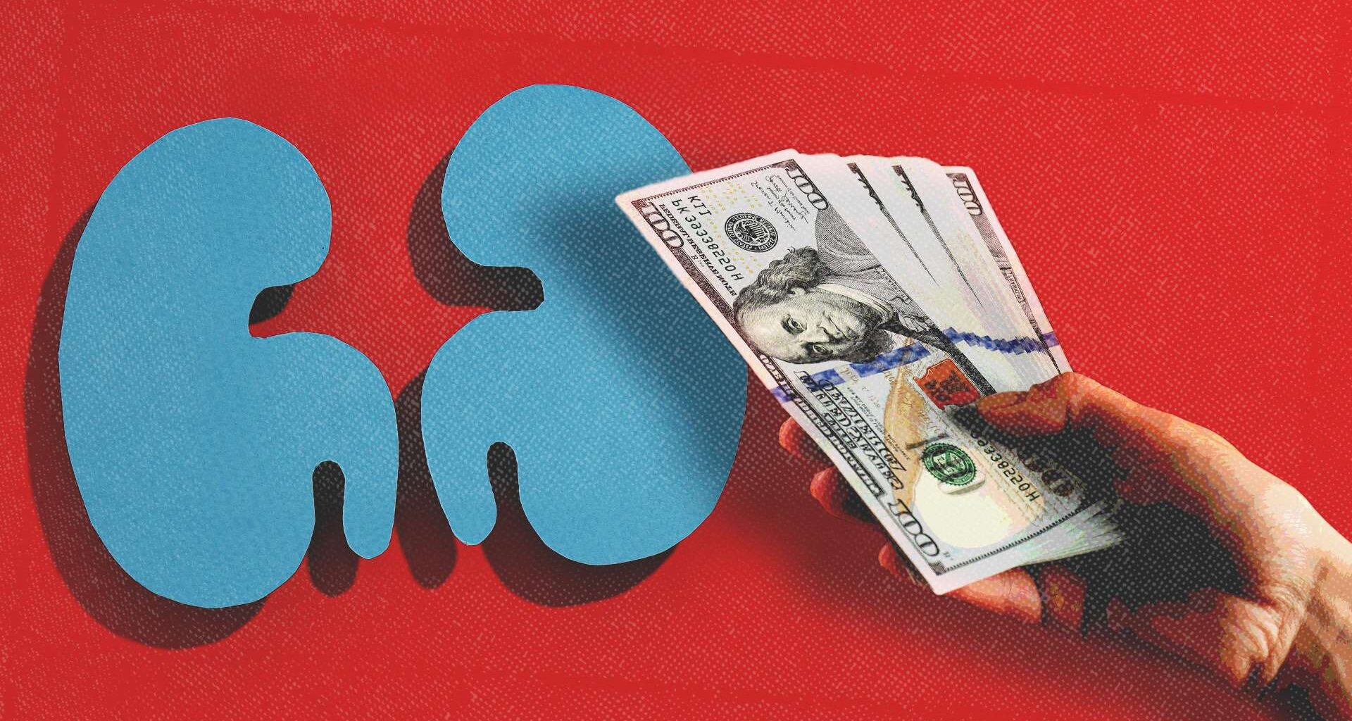 Can you sell your kidney? Not legally—but maybe you should be able to.