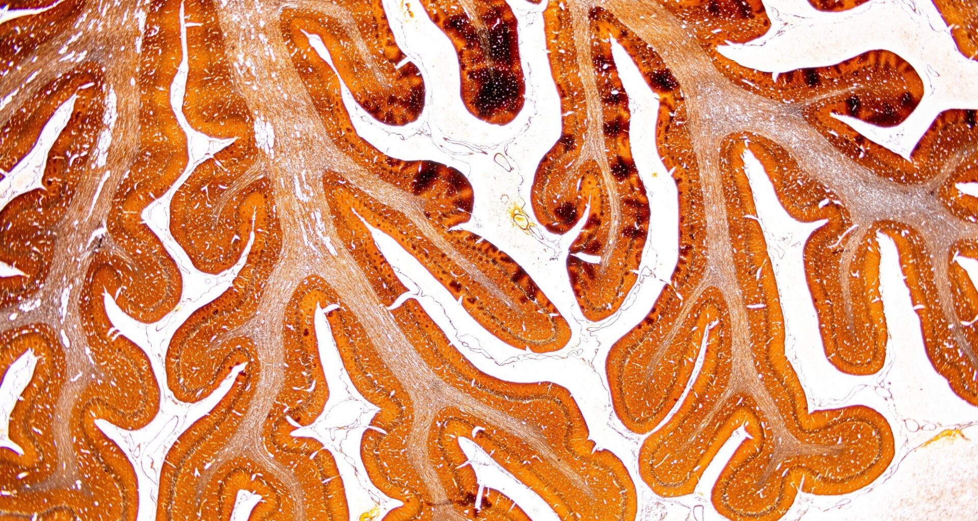 Some mice showed signs of stress resilience before the stress even began
