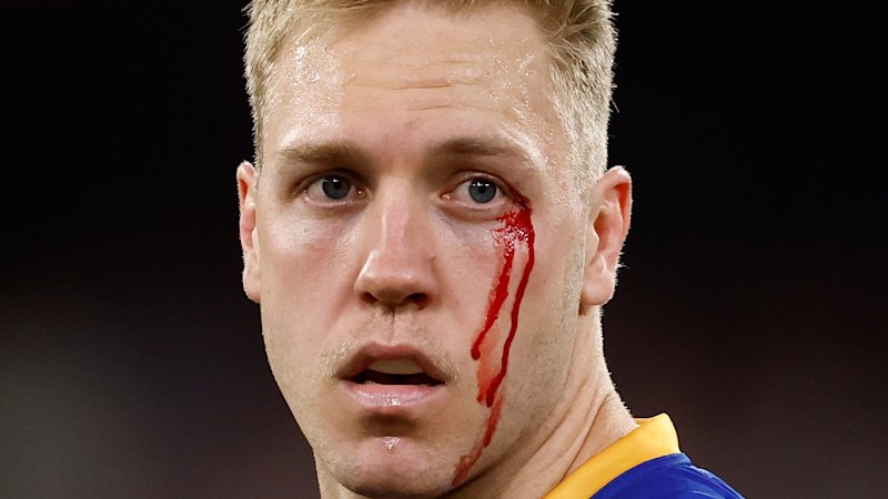 AFL 2026: Brisbane Lions recruit Oscar Allen advances to his first grand final after come-from-behind win over Hawthorn