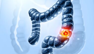 Why are more younger adults in the Eastern Mediterranean facing colorectal cancer?