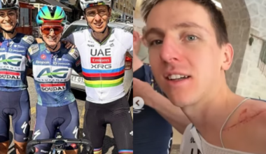 Pogačar is back on his bike and showing off his Vuelta scars