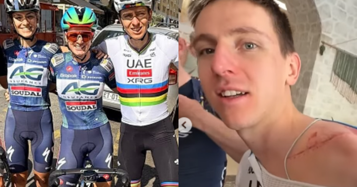 Pogačar is back on his bike and showing off his Vuelta scars