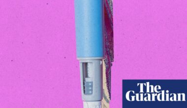 Does GLP-1 use result in significant hair loss? | Well actually