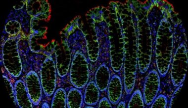 AtlasPlex™ brings custom 5-plex IHC on FFPE tissue into a single day