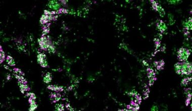 MolBoolean™ measures free and bound proteins in the same experiment