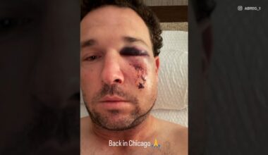 Chicago Cubs' Alex Bregman suffers facial fractures from foul ball, hopeful to return in postseason: sources