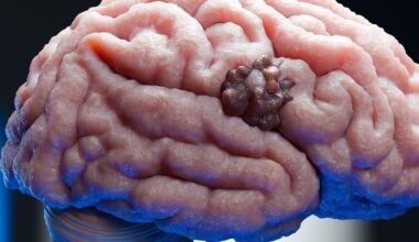 SIRPα drives TNBC brain metastasis via mitochondrial fission and immune evasion | Drug Target Review
