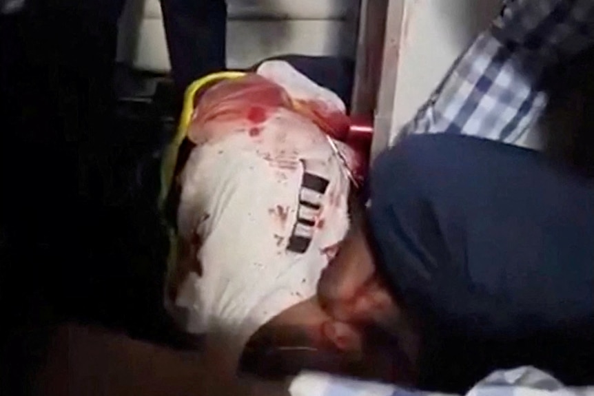 A screenshot of a video showing a man with blood on his white shirt.