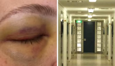 Queensland youth workers to stop work after staff allegedly assaulted, bit