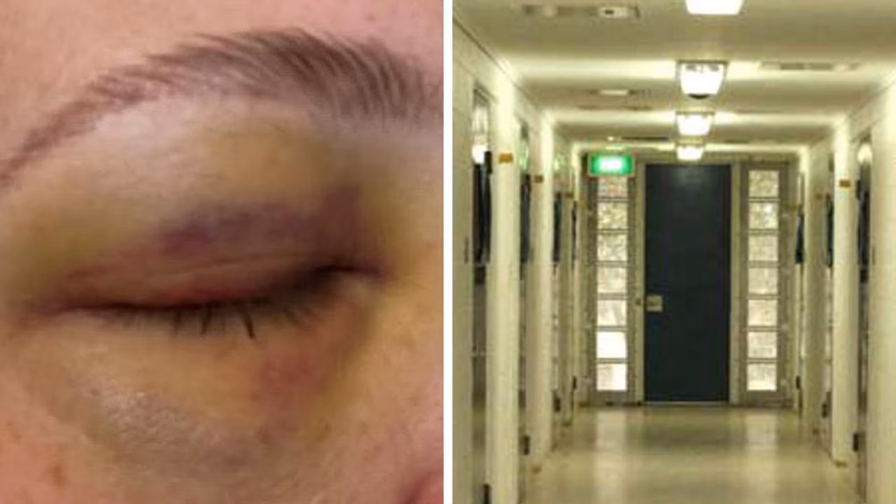 Queensland youth workers to stop work after staff allegedly assaulted, bit
