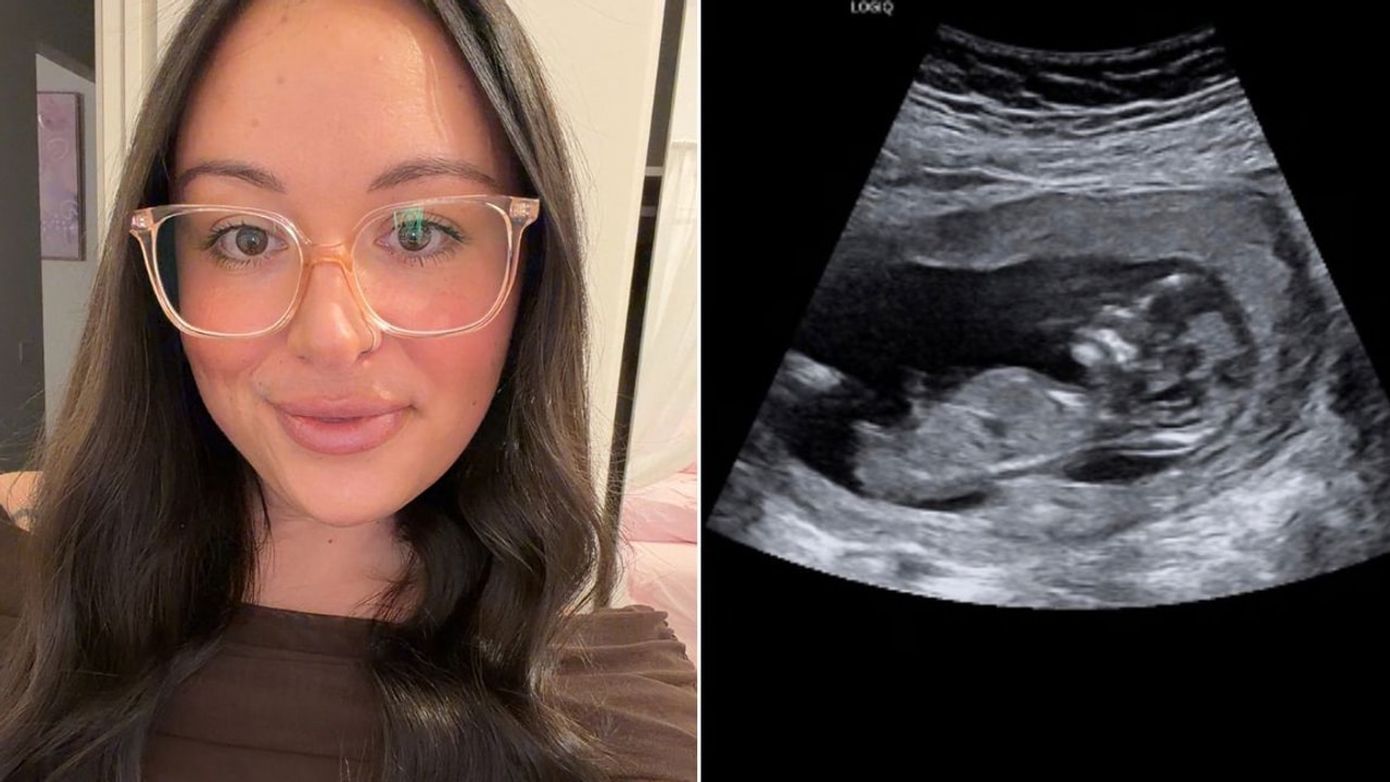 Shocking gap in Australia’s miscarriage data revealed