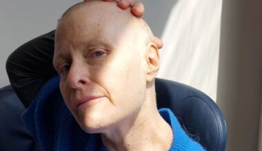 Kiwi actress Susan Brady returns to stage after blood cancer and bone marrow transplant