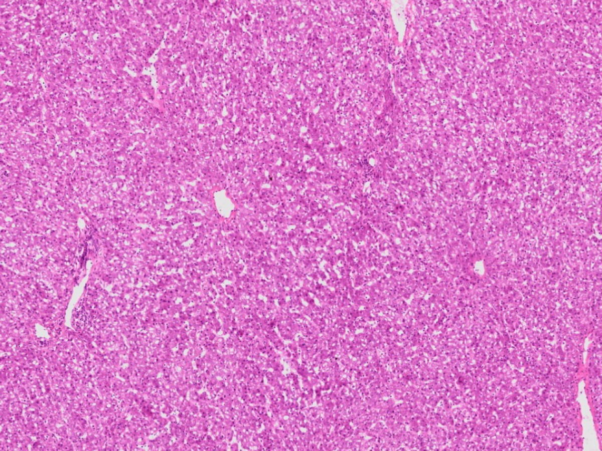 Childhood chemotherapy may increase future disease risk