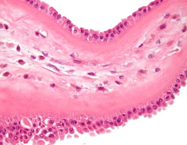Single-cell atlas reveals key macrophage subtypes in myocardial infarction