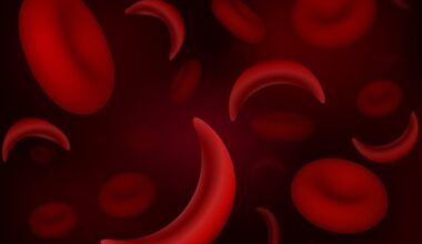 NIH grant funds research on environmental triggers for sickle cell disease