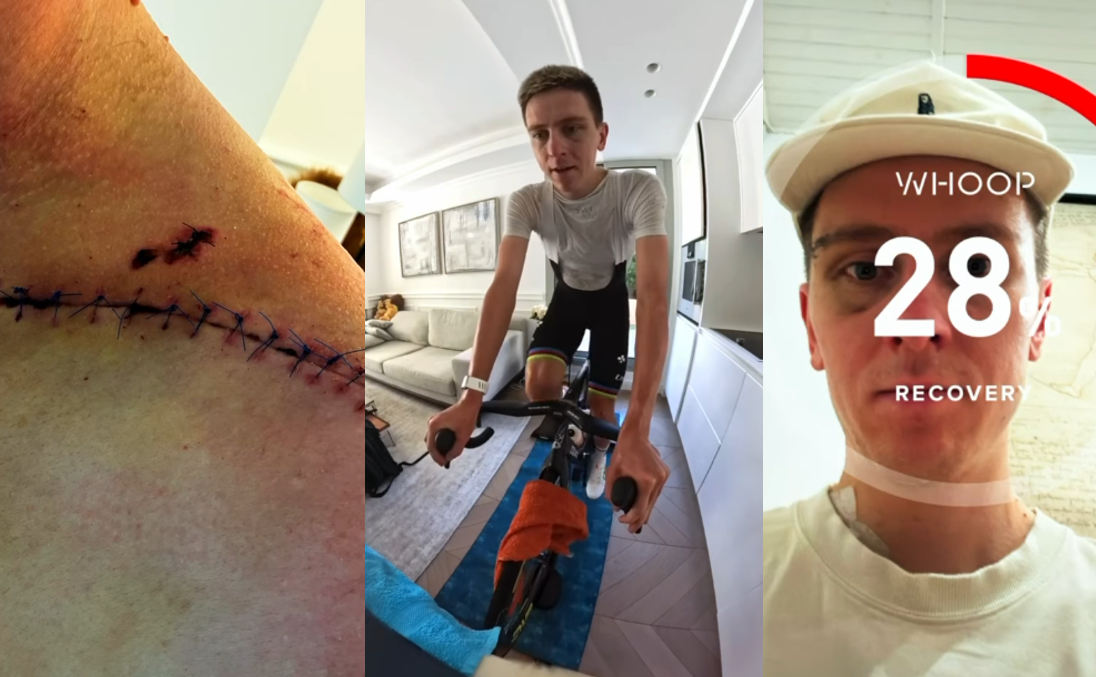 “Collarbone strong, head strong, heart rate high”: Tadej Pogačar is back on his bike (indoors), over two weeks after season-ending Vuelta crash + more on the live blog - Cycling News | Bike Reviews