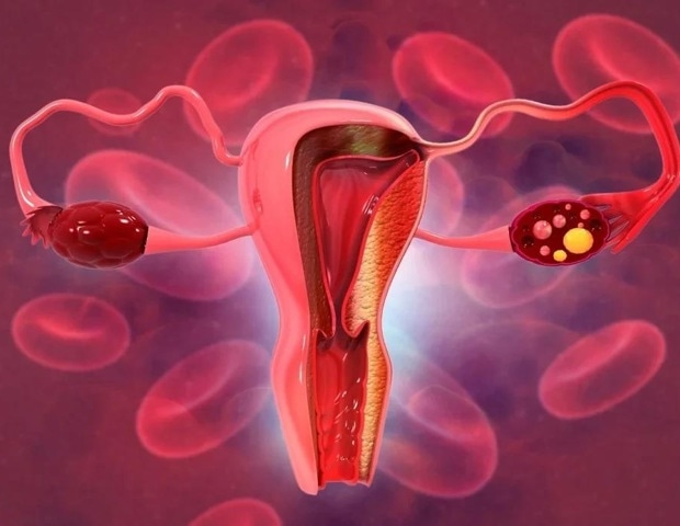 Immunotherapy shows potential for treating rising gynecological tumors