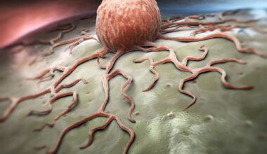 Chaotic tumor environments may trigger cancer cell invasion