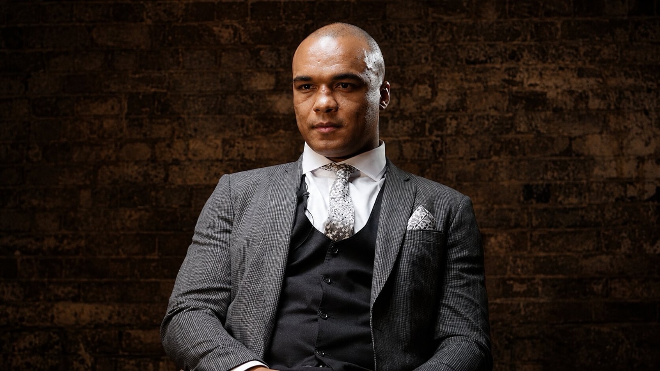 Image: Fabio Wardley Won’t Repeat Daniel Dubois Mistakes