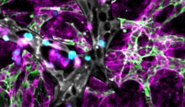 A Window into the Hidden World of Immunity Inside Human Bone Marrow