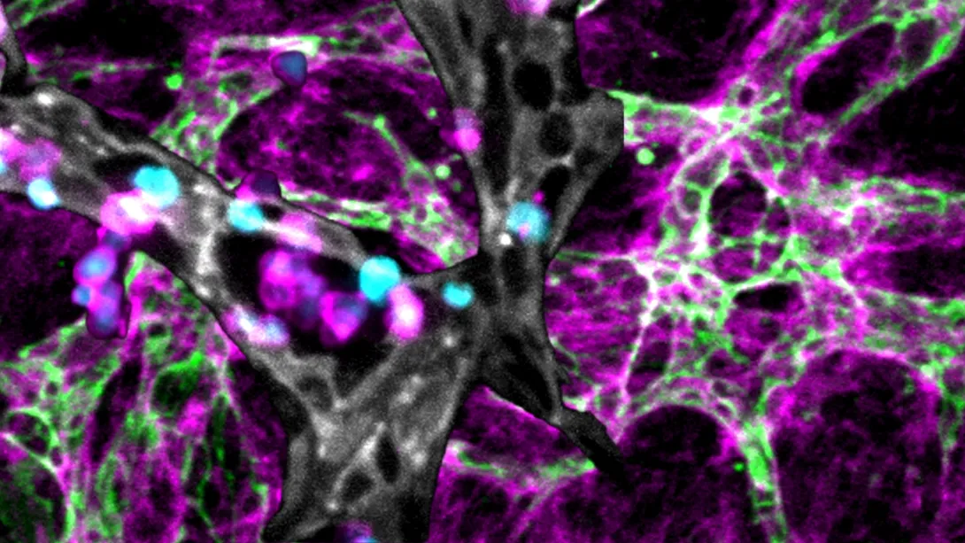 A Window into the Hidden World of Immunity Inside Human Bone Marrow