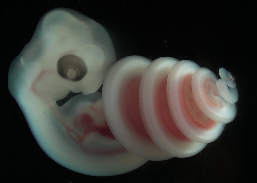 Pale and pink snake embryo photographed up close against a black background