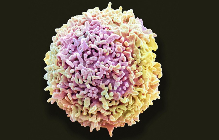Coloured scanning electron micrograph shows a resting human T lymphocyte, a white blood cell involved in immune defence, against a black background. Pink, yellow and cream colouring highlights rough, densely textured cell surface.