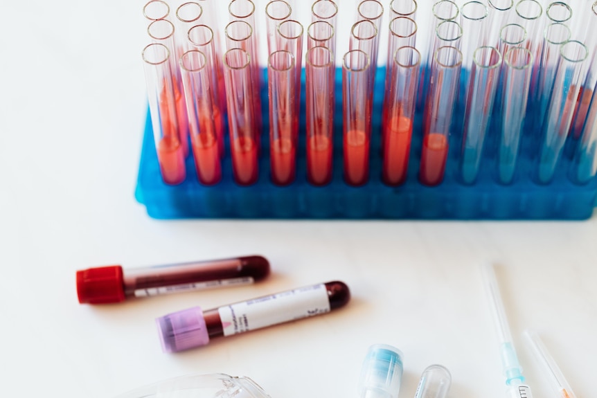 Lab tray of test tubes filled with blood samples.