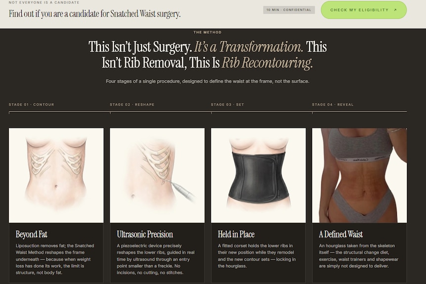 A screenshot from the Snatched Waist website demonstrating the process of rib recontouring