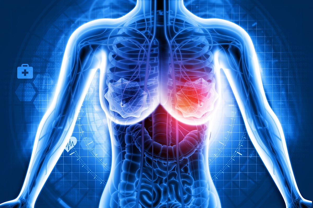 Aggressive breast cancer has a new weakness