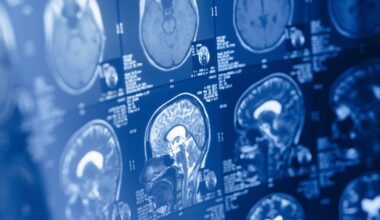 Human brain is two separate organs, new Stanford research finds