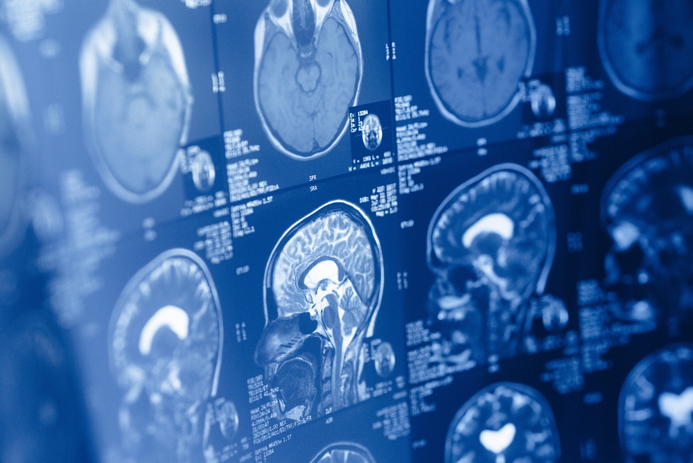 Human brain is two separate organs, new Stanford research finds