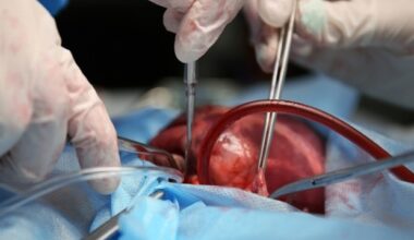 Muscle matters: Simple scan could predict heart surgery risks