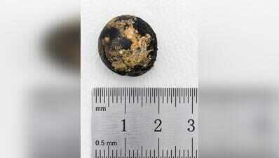 Ayurvedic tablet removed from 70-year-old’s food pipe
