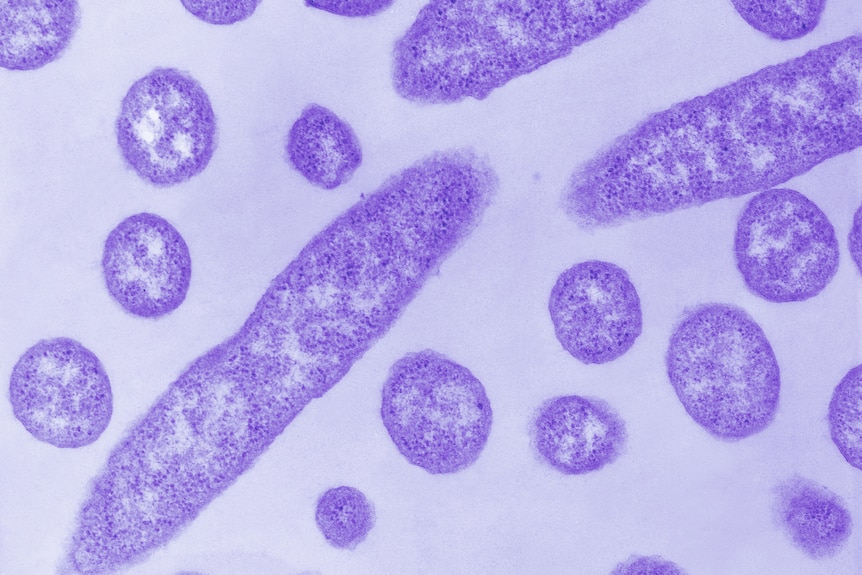 A purple image of microscopic legionella. A few rod-shaped bacteria alongside smaller, circular cells.