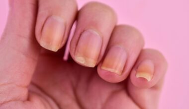 GLP-1 Users Report More Nail Detachments