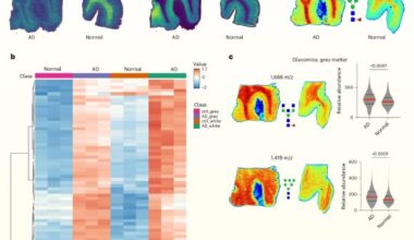 Spatial multiomics analysis reveals hyperglycosylation in human Alzheimer’s brains. Image credit: Hawkinson et al., doi: 10.1038/s42255-026-01538-4.