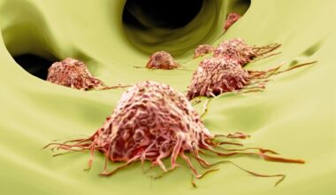 Disrupted circadian rhythms may influence tumor immunity and cancer spread